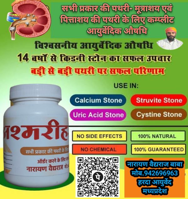 पथरी के लिए एक माह का कम्प्लीट औषधि योग